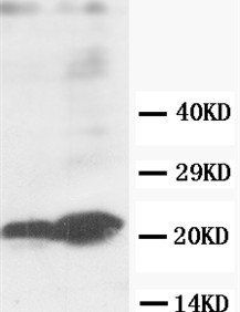 ***GST3/GST pi/GSTP1 Polyclonal Antibody, 100 µg