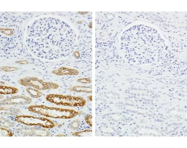 H.O.H. Human on Human Immunodetection Kit