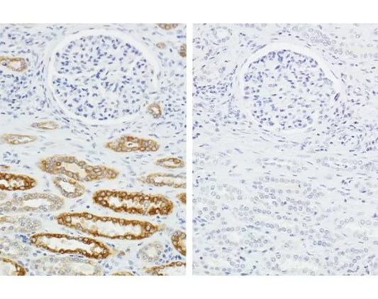 H.O.H. Human on Human Immunodetection Kit