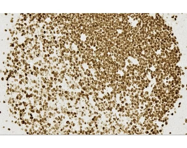 ImmPRESS Horse Anti-Mouse IgG PLUS Polymer Kit, HRP