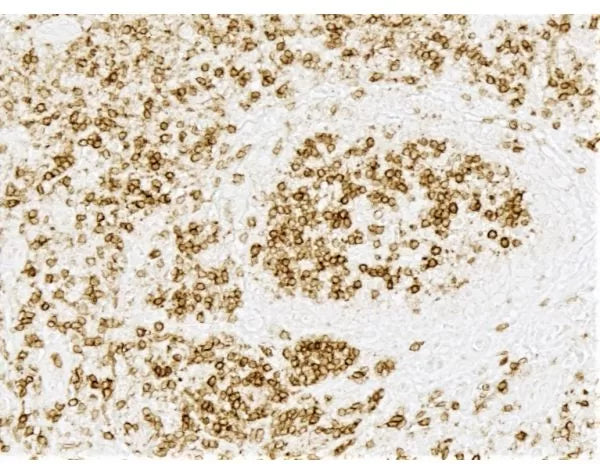 Image of VECTMP7801 - ImmPRESS Horse Anti-Rabbit IgG PLUS Polymer Kit, HRP