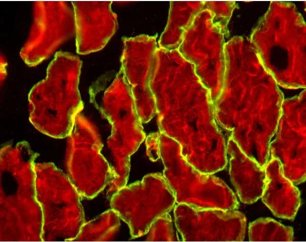 Image of VECTBMK2202 - Vector M.O.M. Kit (Mouse-On-Mouse Immunodetection), Basic