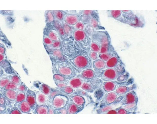 VECTASTAIN® ABC-AP Kit, Alkaline Phosphatase (Rabbit IgG)