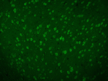 ***Beta Galactosidase Polyclonal Antibody, 50 µL
