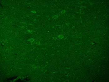 ***Beta Galactosidase Polyclonal Antibody, 50 µL