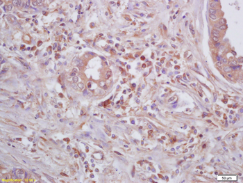 ***Beta Galactosidase Polyclonal Antibody, 100 µL