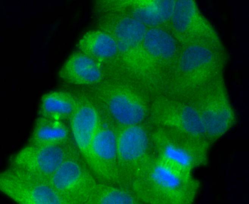***Beta Tubulin Recombinant Rabbit Monoclonal Antibody, 25 µL