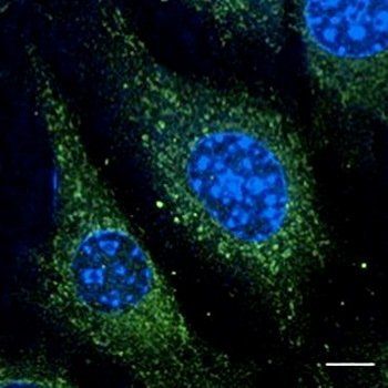 ***Rab5 Polyclonal Antibody, 100 µg
