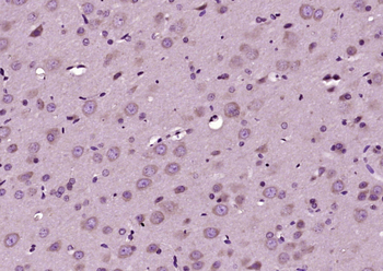 ***Inhibin Alpha Rabbit Polyclonal Antibody, 100 µL