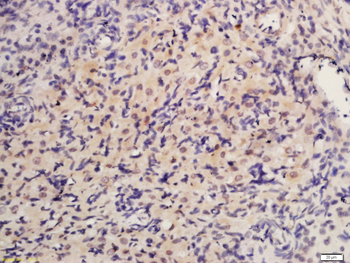 ***Inhibin Alpha Rabbit Polyclonal Antibody, 100 µL