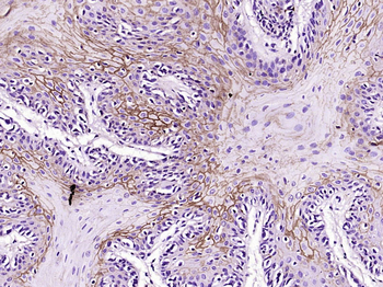 ***Progestin Receptor Beta Polyclonal Antibody, 200 µL