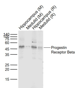 ***Progestin Receptor Beta Polyclonal Antibody, 200 µL