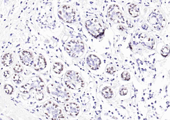***P63 Recombinant Rabbit Monoclonal Antibody, 50 µL