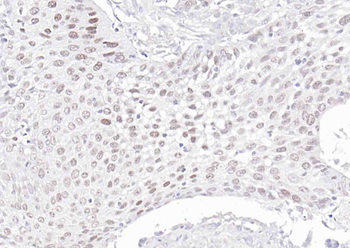 ***P63 Recombinant Rabbit Monoclonal Antibody, 25 µL