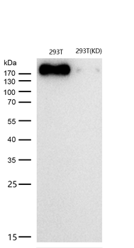 ***ErbB2 (HER2) Rabbit mAb [KD Validated], 50 µL