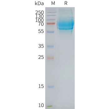 ***Human GCGR full length protein-synthetic nanodisc, 50 µg