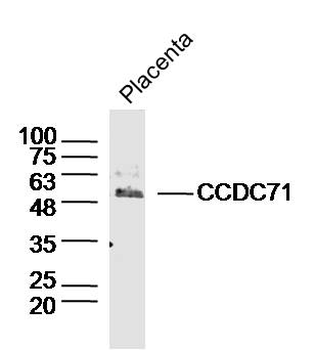 ***CCDC71 Polyclonal Antibody, 100 µL