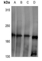 ***Rabbit LPHN2 Polyclonal Antibody, 30 µL