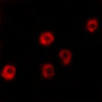 ***Rabbit LPHN2 Polyclonal Antibody, 30 µL
