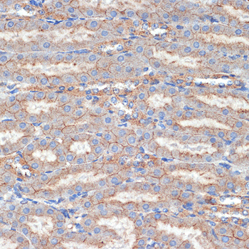 ***Rabbit Polyclonal Antibody to FLOT1, 50 µL