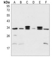 ***Rabbit Polyclonal Antibody to MYF5, 50 µL