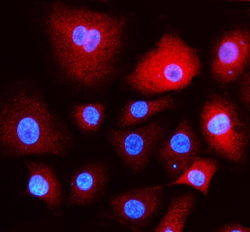 ***EEA1 Polyclonal Antibody, 100 µg