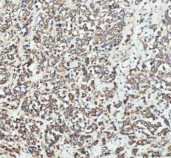 ***EEA1 Polyclonal Antibody, 100 µg
