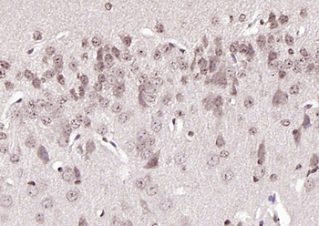 ***Phospho-BRAF (Ser365) Rabbit Polyclonal Antibody, 100 µL