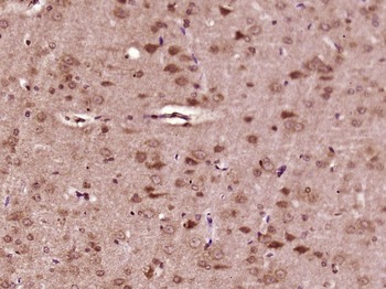 ***Phospho-BRAF (Ser365) Rabbit Polyclonal Antibody, 100 µL