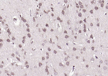 ***Phospho-BRAF (Ser365) Rabbit Polyclonal Antibody, 100 µL