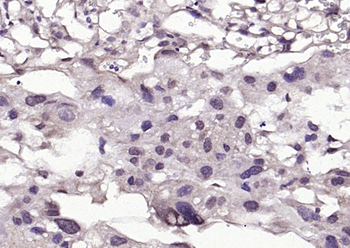***Phospho-BRAF (Ser365) Rabbit Polyclonal Antibody, 100 µL