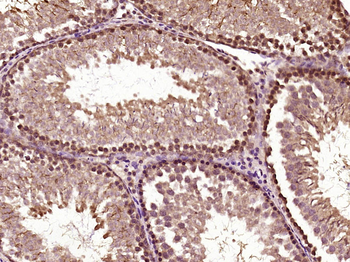 ***Phospho-BRAF (Ser365) Rabbit Polyclonal Antibody, 100 µL