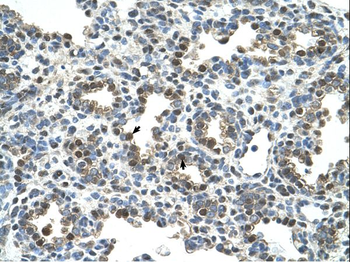 ***GPNMB Rabbit Polyclonal Antibody, 100 µL