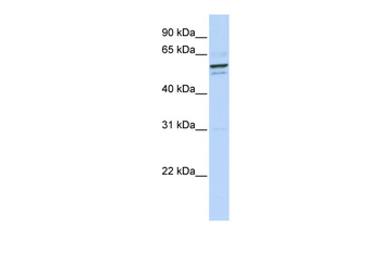 ***GPNMB Rabbit Polyclonal Antibody, 100 µL