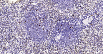 ***PCNA Recombinant Rabbit Monoclonal Antibody (Nuclear Loading Control), 25 µL