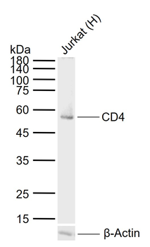 ***CD4 Recombinant Rabbit Monoclonal Antibody, 50 µL
