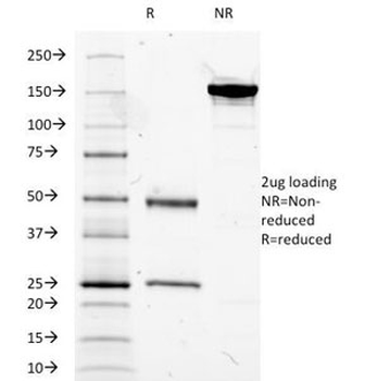 ***MUC5AC Antibody, 20 µg
