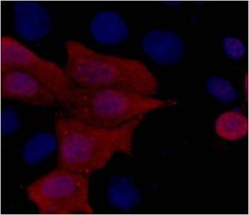 ***His-Tag Mouse Monoclonal Antibody, 100 µL