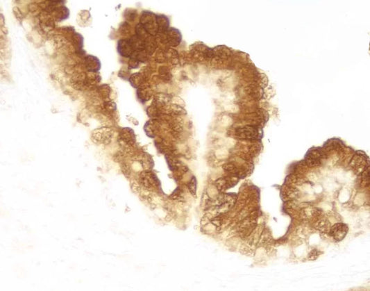 DAB Peroxidase (HRP) Substrate Kit (with Nickel), 3,3’-diaminobenzidine