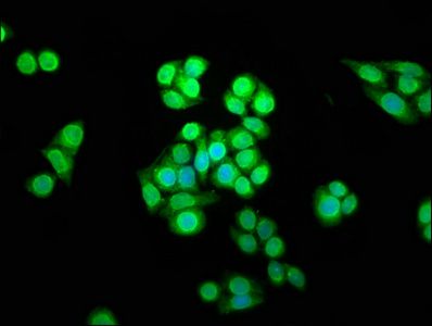 ***SHARPIN Polyclonal Antibody, 50 µg