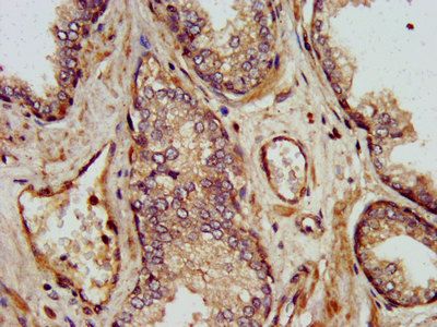 ***SHARPIN Polyclonal Antibody, 50 µg
