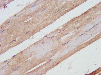 ***SHARPIN Polyclonal Antibody, 50 µg