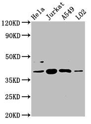 ***SHARPIN Polyclonal Antibody, 50 µg