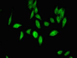 ***UBE3A Antibody, 100 µg