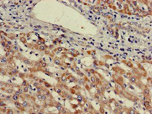 ***UBE3A Antibody, 100 µg